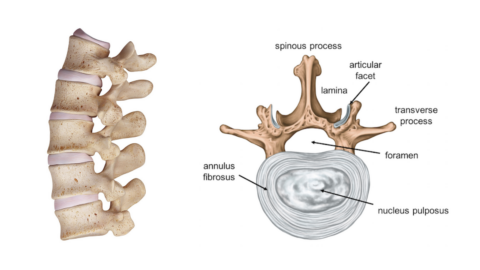vertebra disc back pain
