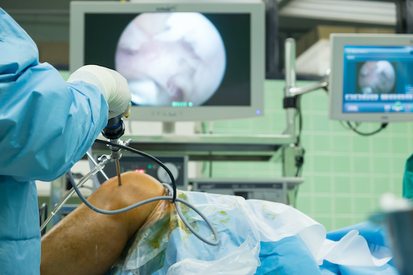 Arthroscopic surgery in patients with knee osteoarthritis is futile and brings unnecessary risks 