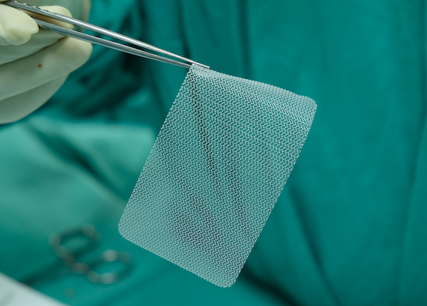 A surgical mesh held by the surgeon 